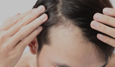 Ankara Saç Dökülmesi Tedavisi ile Sizde Sağlıklı Saçlara Sahip Olun