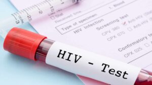 Hiv Testi ile Kısa Sürede Hastalık Teşhisi