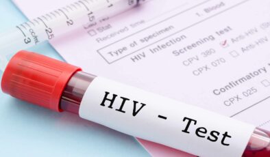 Hiv Testi ile Kısa Sürede Hastalık Teşhisi